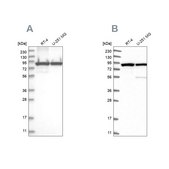 Anti-DDX1 antibody produced in rabbit Prestige Antibodies® Powered by Atlas Antibodies, affinity isolated antibody, buffered aqueous glycerol solution