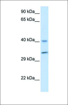 Anti-ALKBH3 antibody produced in rabbit affinity isolated antibody