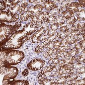 Anti-CYB561A3 antibody produced in rabbit Prestige Antibodies® Powered by Atlas Antibodies, affinity isolated antibody, buffered aqueous glycerol solution