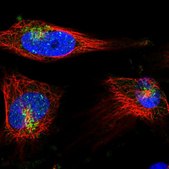 Anti-STX6 antibody produced in rabbit Prestige Antibodies® Powered by Atlas Antibodies, affinity isolated antibody, buffered aqueous glycerol solution