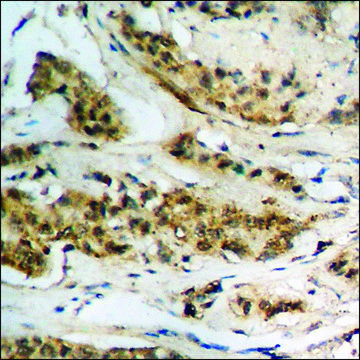 Anti-phospho-Tau (pThr181) antibody produced in rabbit affinity isolated antibody