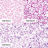 HPV/p16 Analyte Control Cell line controls for immunohistochemistry and in situ hybridization