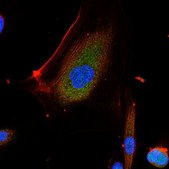 Anti-ICAT Antibody from rabbit, purified by affinity chromatography