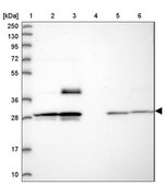 Anti-MXRA7 antibody produced in rabbit Prestige Antibodies® Powered by Atlas Antibodies, affinity isolated antibody, buffered aqueous glycerol solution