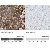 Anti-CEL antibody produced in rabbit Prestige Antibodies® Powered by Atlas Antibodies, affinity isolated antibody, buffered aqueous glycerol solution