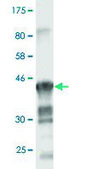 Monoclonal Anti-CLDN1 antibody produced in mouse clone 2E2-H5, purified immunoglobulin, buffered aqueous solution