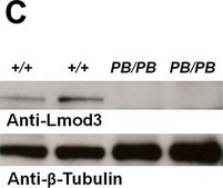 Anti-LMOD3 antibody produced in rabbit Prestige Antibodies® Powered by Atlas Antibodies, affinity isolated antibody, buffered aqueous glycerol solution