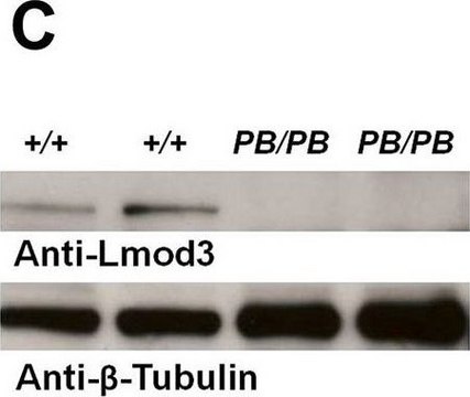 Anti-LMOD3 antibody produced in rabbit Prestige Antibodies&#174; Powered by Atlas Antibodies, affinity isolated antibody, buffered aqueous glycerol solution