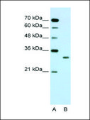 Anti-SBDS (AB1) antibody produced in rabbit IgG fraction of antiserum