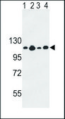 ANTI-COL17A1 (CENTER) antibody produced in rabbit IgG fraction of antiserum, buffered aqueous solution