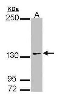 Anti-AUTS2 antibody produced in rabbit affinity isolated antibody, buffered aqueous solution