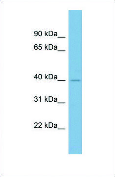 Anti-A4GALT antibody produced in rabbit affinity isolated antibody