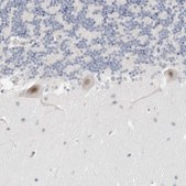 Anti-TSEN2 antibody produced in rabbit Prestige Antibodies® Powered by Atlas Antibodies, affinity isolated antibody, buffered aqueous glycerol solution, ab3