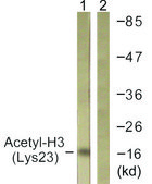 Anti-Histone H3 (Acetyl-Lys23) antibody produced in rabbit affinity isolated antibody