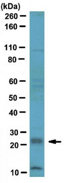 Anti-RGS4 Antibody serum, from rabbit