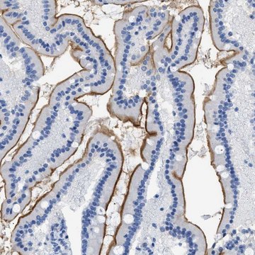 Anti-DLC1 antibody produced in rabbit affinity isolated antibody, buffered aqueous glycerol solution