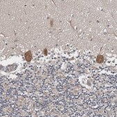 Anti-CHML antibody produced in rabbit Prestige Antibodies® Powered by Atlas Antibodies, affinity isolated antibody, buffered aqueous glycerol solution