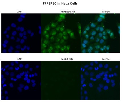 Anti-PPP1R10 antibody produced in rabbit affinity isolated antibody