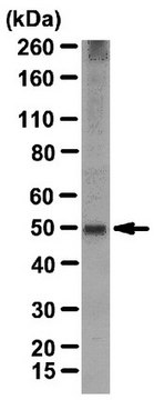 Anti-FucT-III Antibody from rabbit, purified by affinity chromatography