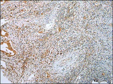 Anti-LYPLA2 affinity isolated antibody