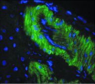 Monoclonal Anti-Nitrotyrosine antibody produced in mouse clone 39B6, 1 mg/mL, purified immunoglobulin