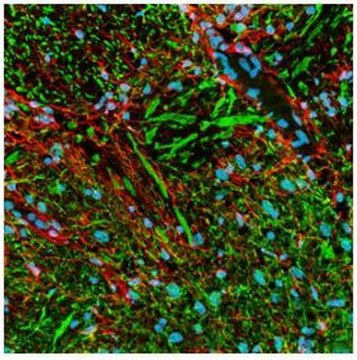 PhosphoDetect Anti-Neurofilament H Mouse mAb (SMI-31) liquid, clone SMI-31, Calbiochem&#174;