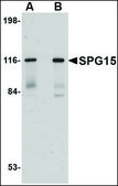 Anti-SPG15 antibody produced in rabbit affinity isolated antibody, buffered aqueous solution