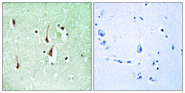 Anti-CYCLIN D1, C-Terminal antibody produced in rabbit affinity isolated antibody