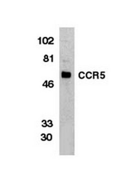 Anti-C-C Chemokine Receptor 5 Antibody, NT Chemicon&#174;, from rabbit