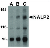 Anti-NALP1 antibody produced in rabbit affinity isolated antibody, buffered aqueous solution