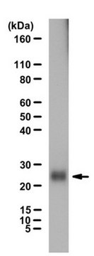 Anti-Ubiquitin Antibody from rabbit