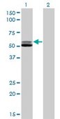 Monoclonal Anti-GSR antibody produced in mouse clone 6B4, purified immunoglobulin, buffered aqueous solution