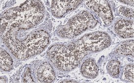 Anti-Golgin-97 Antibody, clone 4K16, ZooMAb® Rabbit Monoclonal recombinant, expressed in HEK 293 cells