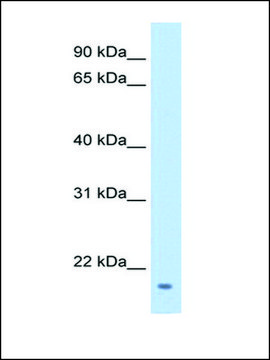 Anti-FAM107A IgG fraction of antiserum