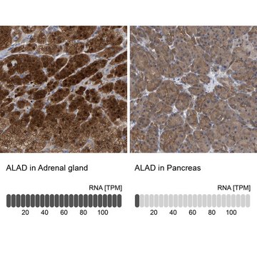 Anti-ALAD antibody produced in rabbit Prestige Antibodies&#174; Powered by Atlas Antibodies, affinity isolated antibody, buffered aqueous glycerol solution, Ab1