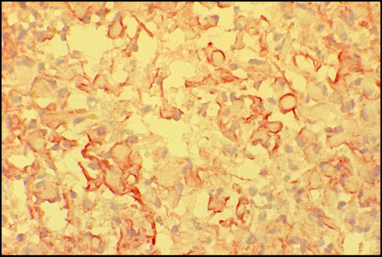 Anti-Mouse IgM (&#956;-chain specific)–Peroxidase antibody produced in goat affinity isolated antibody, buffered aqueous solution