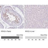 Anti-RFX2 antibody produced in rabbit Prestige Antibodies® Powered by Atlas Antibodies, affinity isolated antibody, buffered aqueous glycerol solution