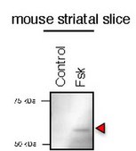 Anti-phospho RasGRP2 (Ser554) from rabbit