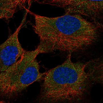 Anti-St6Galnac6 Antibody Produced In Rabbit Prestige Antibodies&#174; Powered by Atlas Antibodies, affinity isolated antibody, buffered aqueous glycerol solution