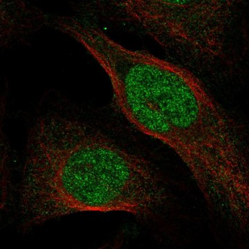 Anti-Osgep Antibody Produced In Rabbit Prestige Antibodies&#174; Powered by Atlas Antibodies, affinity isolated antibody, buffered aqueous glycerol solution