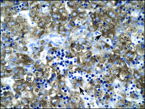 Anti-CLDN1 antibody produced in rabbit affinity isolated antibody