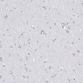 Monoclonal Anti-MS4A1 antibody produced in mouse Prestige Antibodies® Powered by Atlas Antibodies, clone CL10613, purified antibody (Protein A)