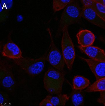 Anti-Rabies glycoprotein Antibody, clone 24-3F-10 ZooMAb&#174; Mouse Monoclonal recombinant, expressed in HEK 293 cells