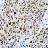 Anti-Phospho-FOXO3A-S425 antibody produced in rabbit
