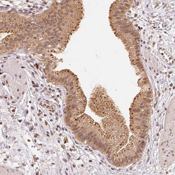 Anti-GUSB antibody produced in rabbit Prestige Antibodies&#174; Powered by Atlas Antibodies, affinity isolated antibody, buffered aqueous glycerol solution