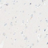 Anti-LAT antibody produced in rabbit Prestige Antibodies® Powered by Atlas Antibodies, affinity isolated antibody, buffered aqueous glycerol solution