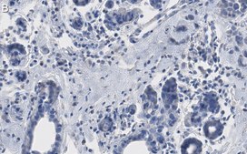 Anti-phospho-p53 (Ser15) Antibody, clone 5L22 ZooMAb® Rabbit Monoclonal recombinant, expressed in HEK 293 cells