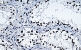 Anti-ZC3H13 Antibody, clone 1F4 ZooMAb® Rabbit Monoclonal recombinant, expressed in HEK 293 cells