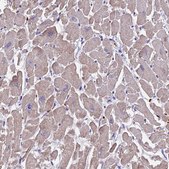 Anti-TNNC2 antibody produced in rabbit Prestige Antibodies® Powered by Atlas Antibodies, affinity isolated antibody, buffered aqueous glycerol solution