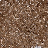 抗 FYCO1 兔抗 Prestige Antibodies® Powered by Atlas Antibodies, affinity isolated antibody, buffered aqueous glycerol solution